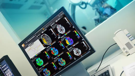 Krypton : le bouquet de services de partage et d'échange d'imagerie médicale
