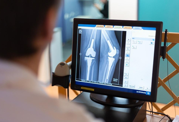 Un médecin analyse une radiographie sur un écran d'ordinateur