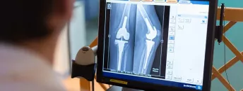Un médecin analyse une radiographie sur un écran d'ordinateur