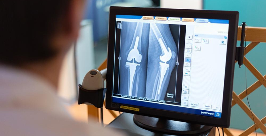 Un médecin analyse une radiographie sur un écran d'ordinateur